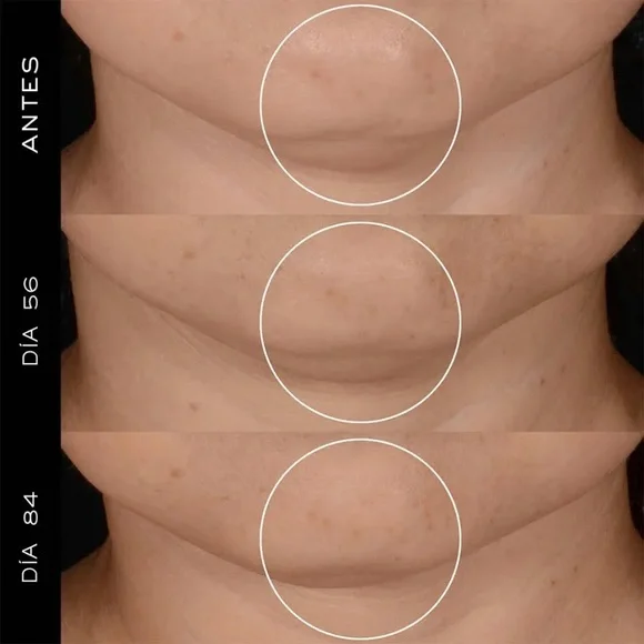 Rénergie H.P.N. 300-Peptide Cream - NIB - Picture 5 of 5